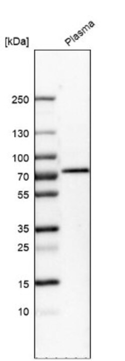 Protein S/PROS1 Antibody, Novus Biologicals 0.1mL; Unlabeled:Antibodies,